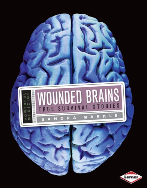 Wounded Brains (e-bog) af Markle, Sandra