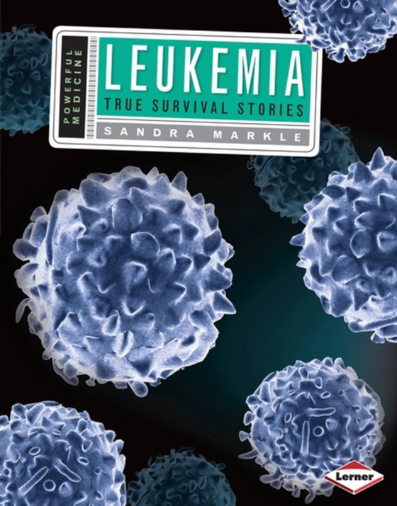 Leukemia