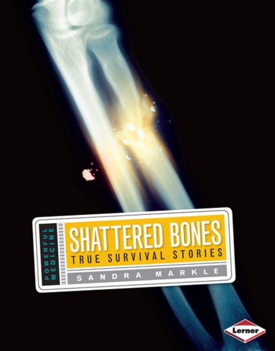 Shattered Bones (e-bog) af Markle, Sandra