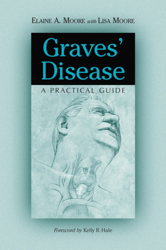 Graves' Disease (e-bog) af Elaine A. Moore, Moore