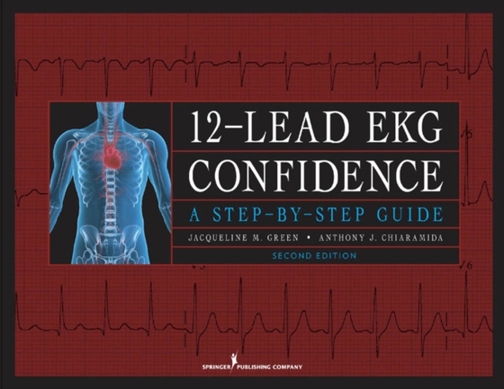 12-Lead EKG Confidence, Second Edition (e-bog) af Anthony J. Chiaramida, MD, FACC