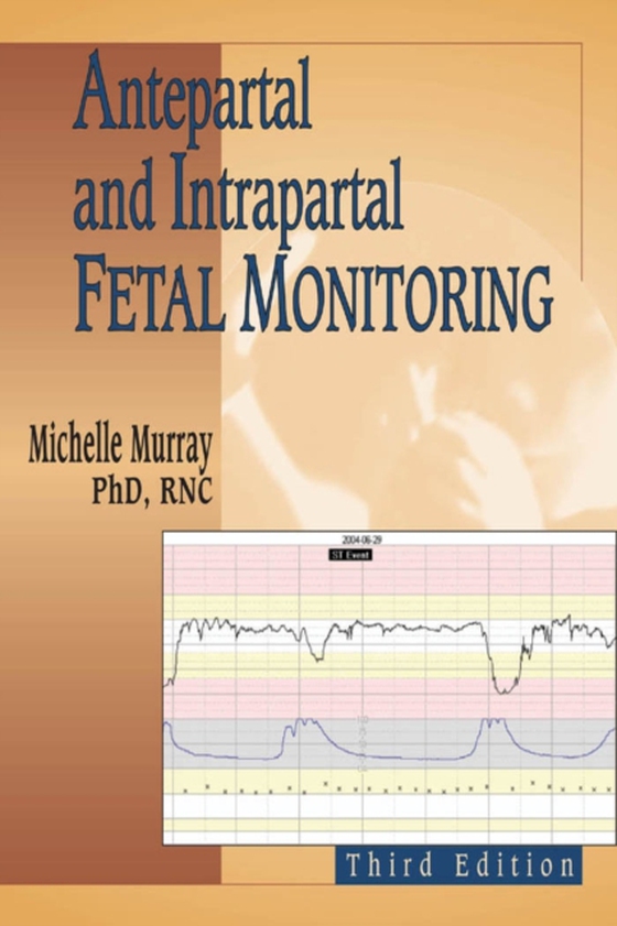 Antepartal and Intrapartal Fetal Monitoring (e-bog) af Michelle Murray, PhD, RNC