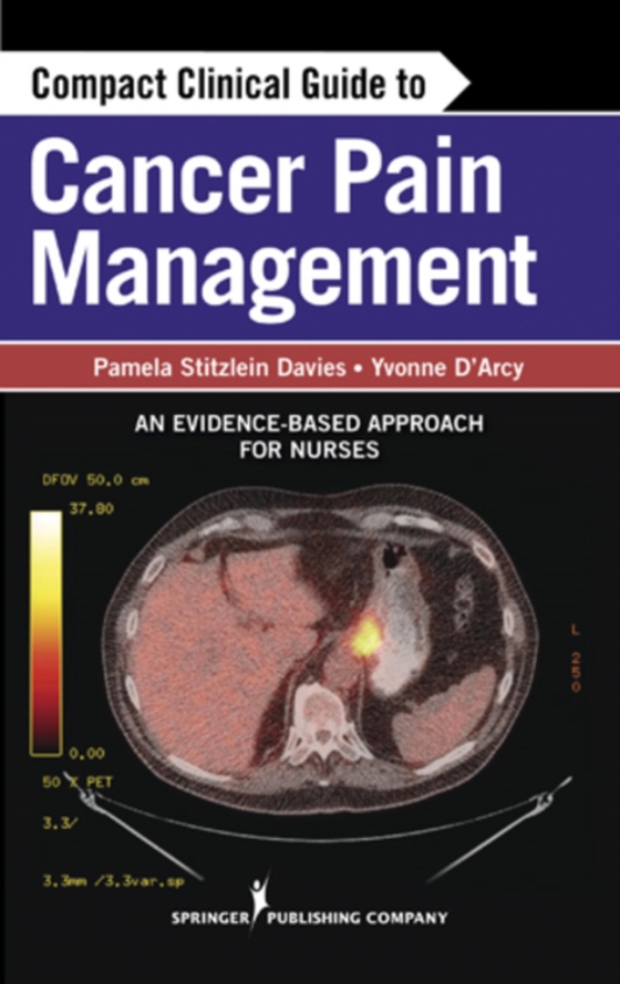 Compact Clinical Guide to Cancer Pain Management (e-bog) af Yvonne D'Arcy, MS, APN-C, CNS, FAANP