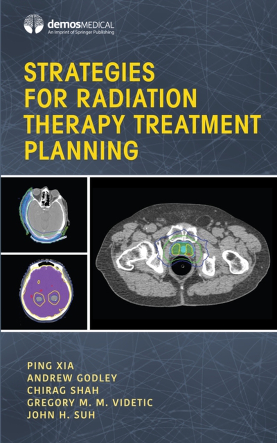 Strategies for Radiation Therapy Treatment Planning (e-bog) af -