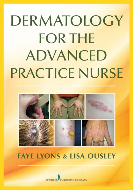 Dermatology for the Advanced Practice Nurse (e-bog) af Lisa Ousley, DNP, RN, FNP-C