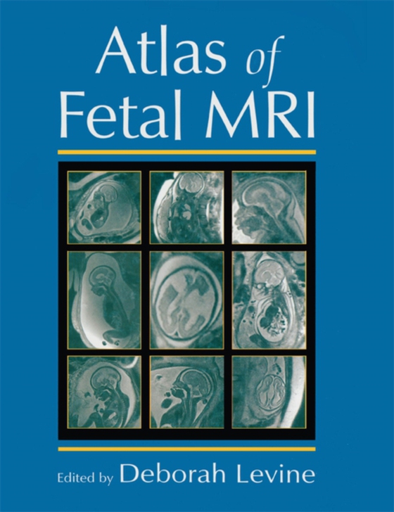 Atlas of Fetal MRI (e-bog) af Levine, Deborah