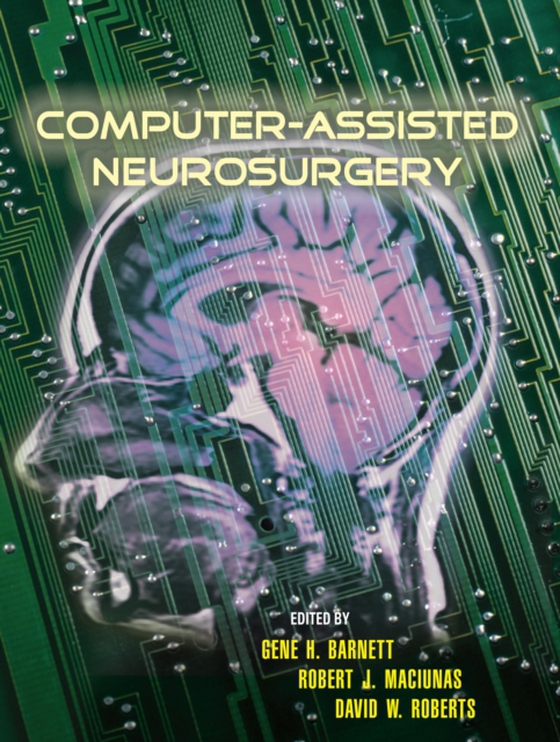 Computer-Assisted Neurosurgery (e-bog) af -