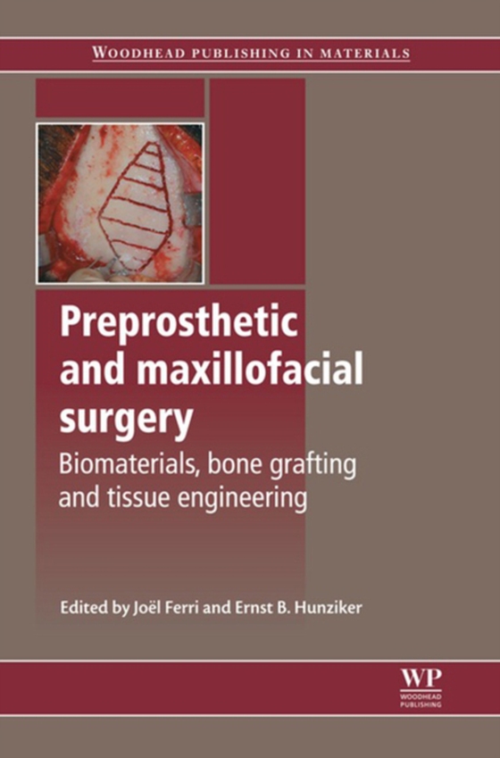 Preprosthetic and Maxillofacial Surgery (e-bog) af -