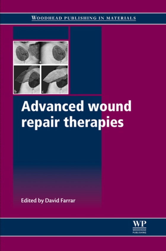 Advanced Wound Repair Therapies (e-bog) af -