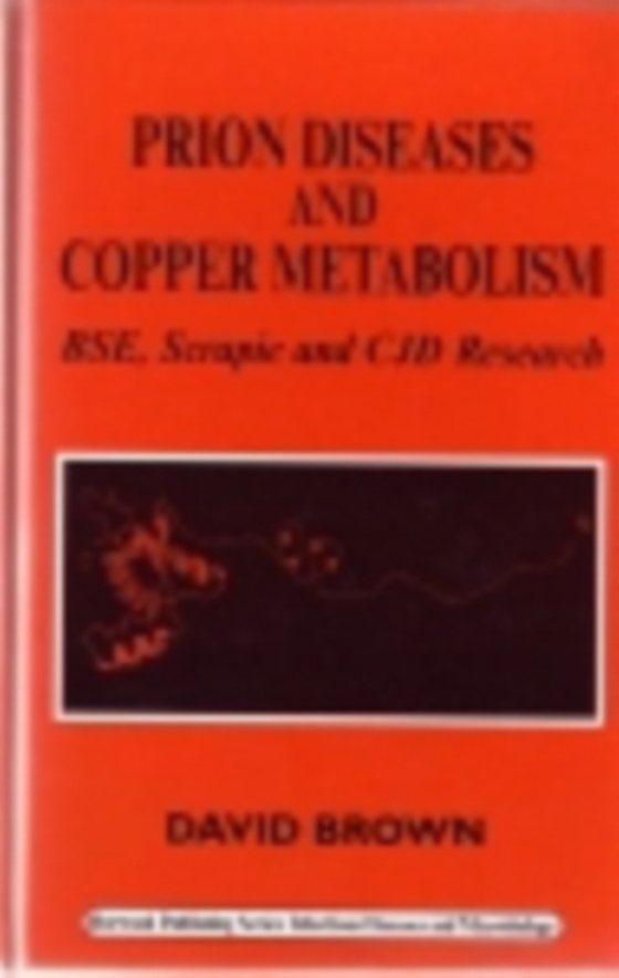 Prion Diseases and Copper Metabolism