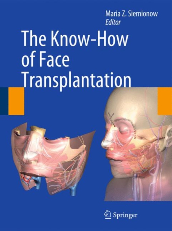 Know-How of Face Transplantation (e-bog) af -