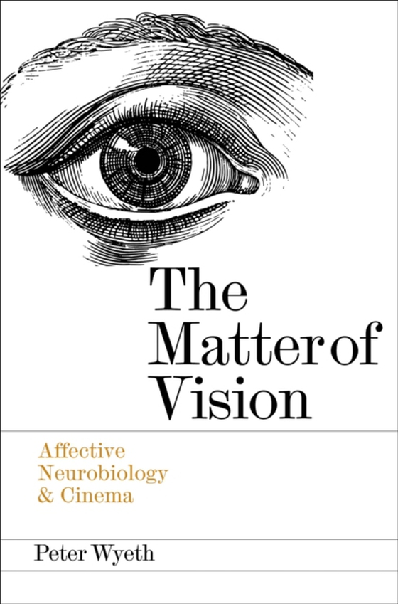 Matter of Vision