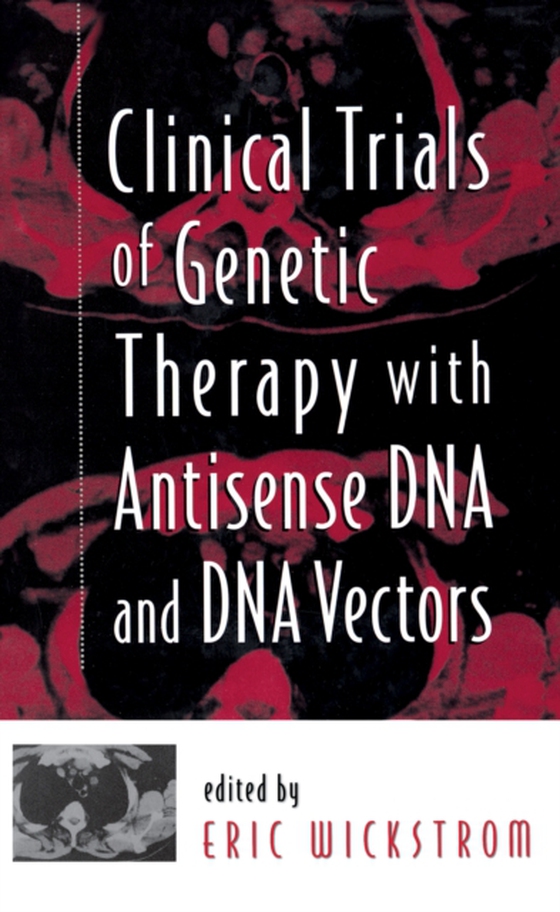 Clinical Trials of Genetic Therapy with Antisense DNA and DNA Vectors (e-bog) af -