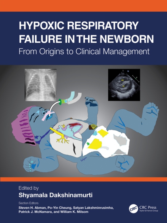 Hypoxic Respiratory Failure in the Newborn