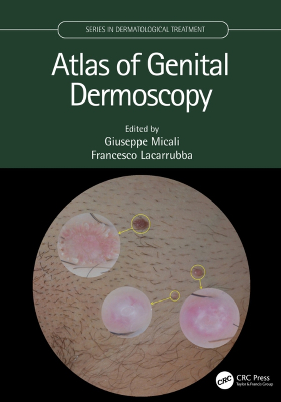 Atlas of Genital Dermoscopy (e-bog) af -