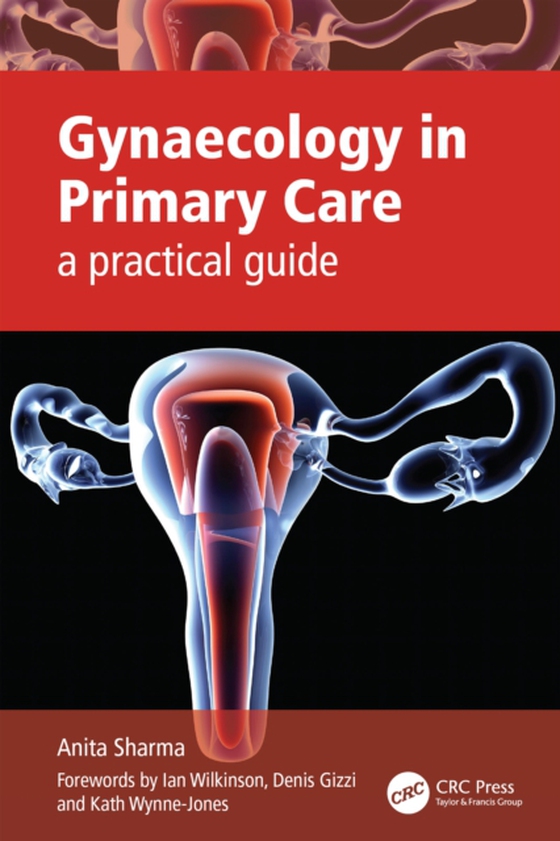 Gynaecology in Primary Care (e-bog) af Sharma, Anita