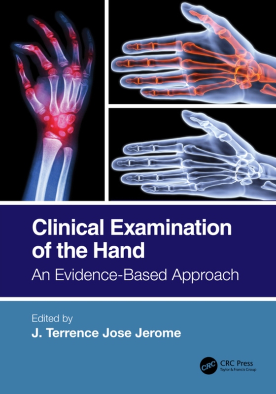 Clinical Examination of the Hand (e-bog) af -