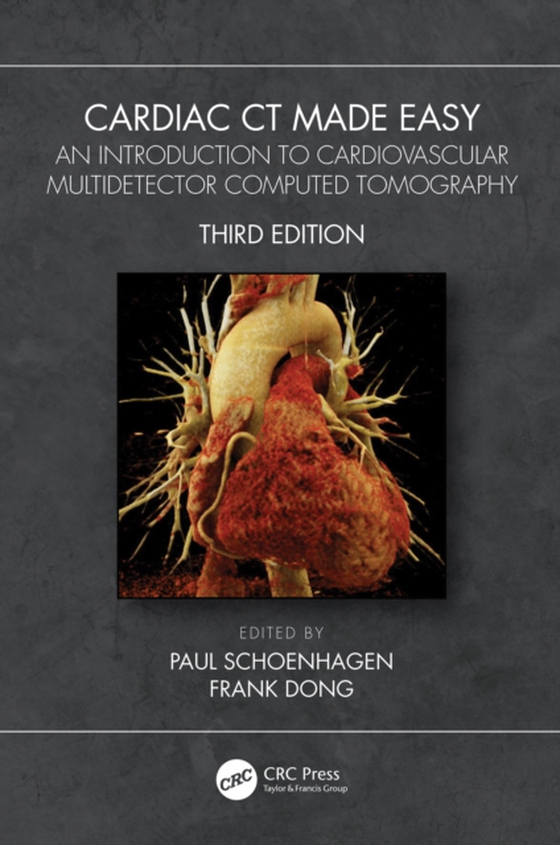 Cardiac CT Made Easy