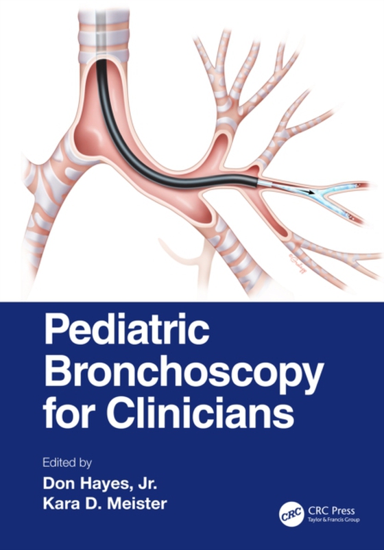 Pediatric Bronchoscopy for Clinicians (e-bog) af -