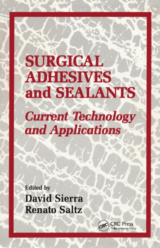 Surgical Adhesives & Sealants (e-bog) af Sierra, David H.