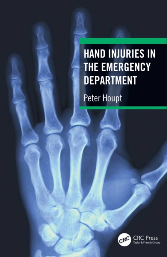 Hand Injuries in the Emergency Department (e-bog) af Houpt, Peter