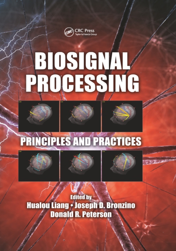 Biosignal Processing (e-bog) af -