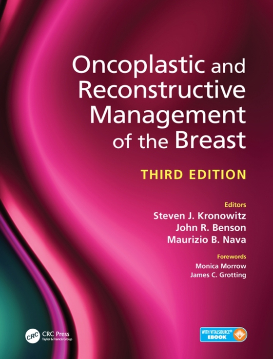 Oncoplastic and Reconstructive Management of the Breast, Third Edition (e-bog) af -