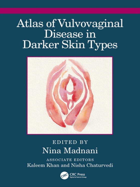 Atlas of Vulvovaginal Disease in Darker Skin Types (e-bog) af -