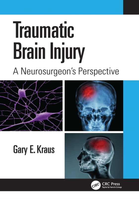 Traumatic Brain Injury: A Neurosurgeon's Perspective (e-bog) af Kraus, Gary E.