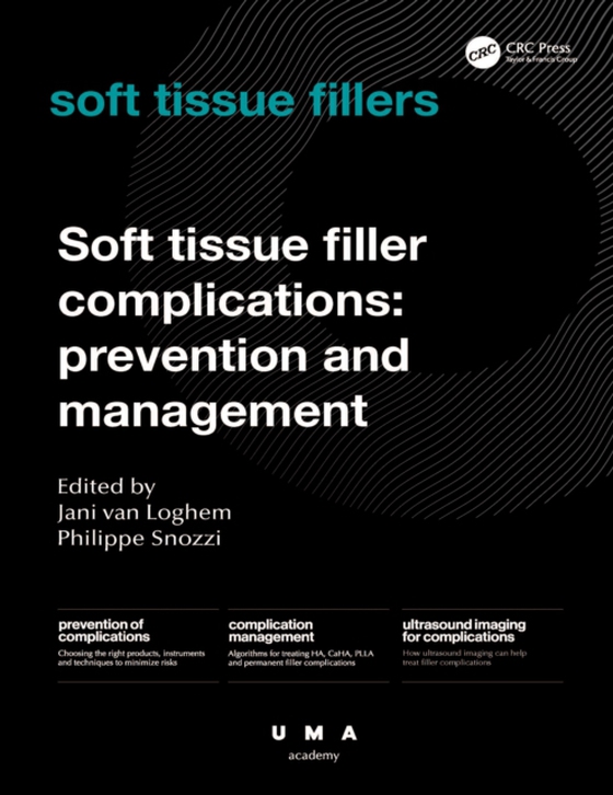 Soft Tissue Filler Complications (e-bog) af -