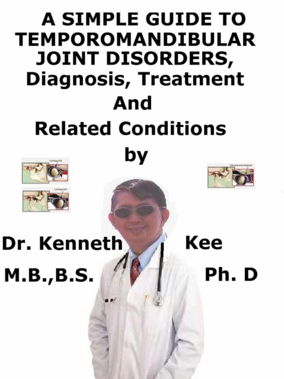 Simple Guide to Temporomandibular Joint Disorders, Diagnosis, Treatment and Related Conditions