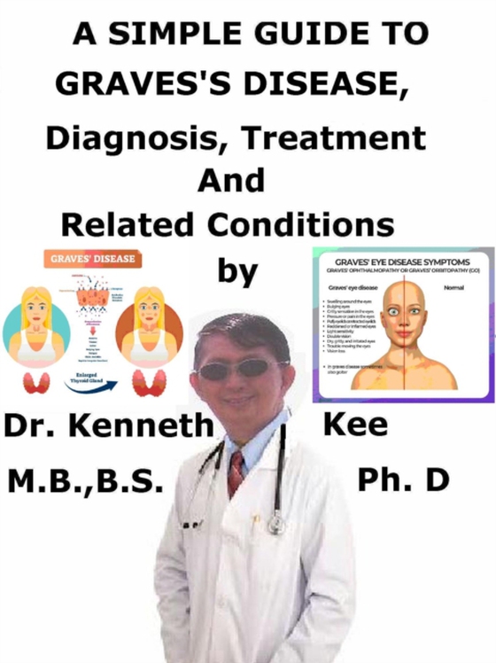 Simple Guide to Graves's Disease, Diagnosis, Treatment and Related Conditions (e-bog) af Kee, Kenneth