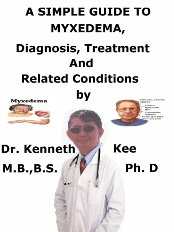 Simple Guide to Myxedema, Diagnosis, Treatment and Related Conditions (e-bog) af Kee, Kenneth