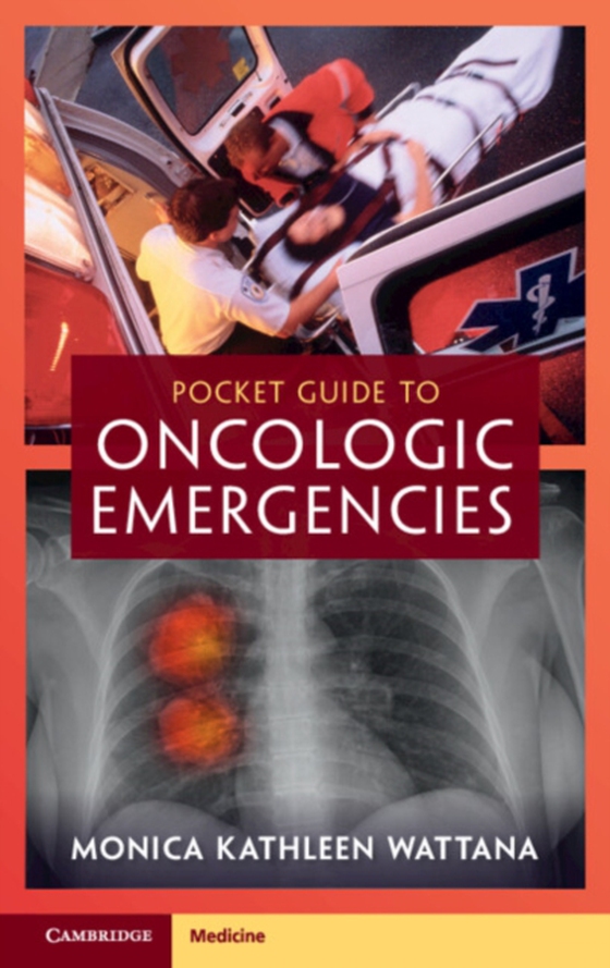 Pocket Guide to Oncologic Emergencies (e-bog) af Wattana, Monica Kathleen