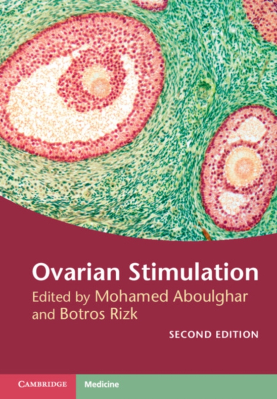 Ovarian Stimulation (e-bog) af -