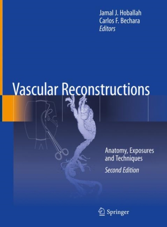 Vascular Reconstructions (e-bog) af -