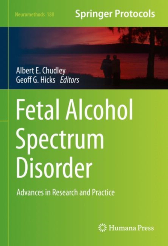 Fetal Alcohol Spectrum Disorder (e-bog) af -
