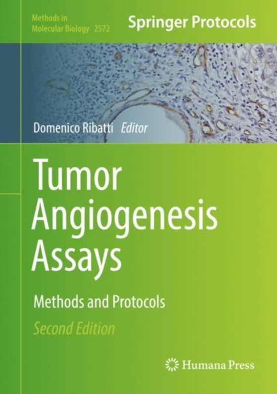 Tumor Angiogenesis Assays (e-bog) af -