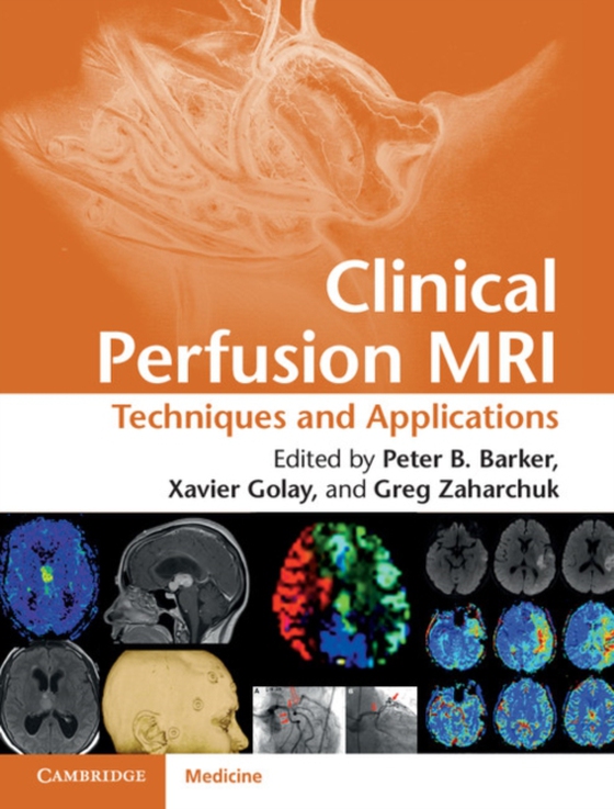 Clinical Perfusion MRI (e-bog) af -