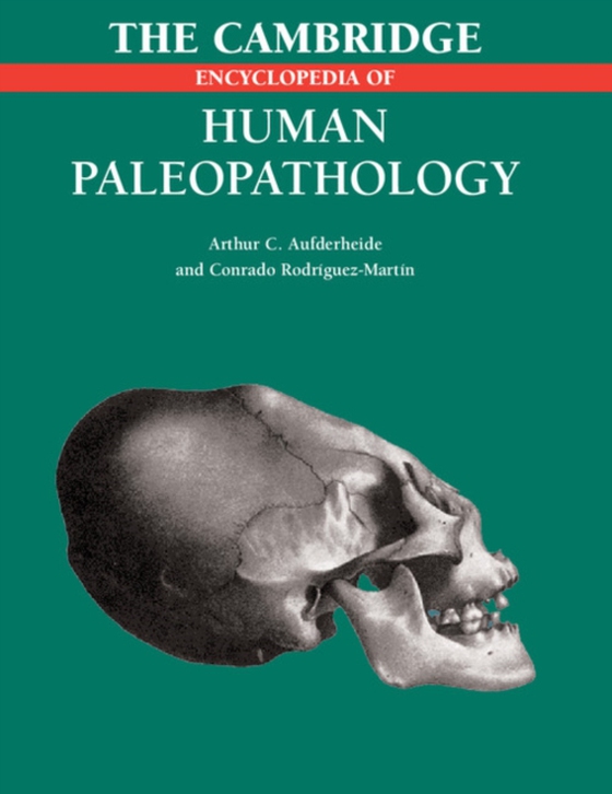 Cambridge Encyclopedia of Human Paleopathology (e-bog) af Rodriguez-Martin, Conrado