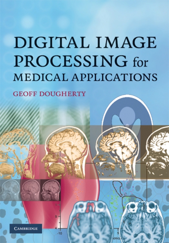 Digital Image Processing for Medical Applications (e-bog) af Dougherty, Geoff