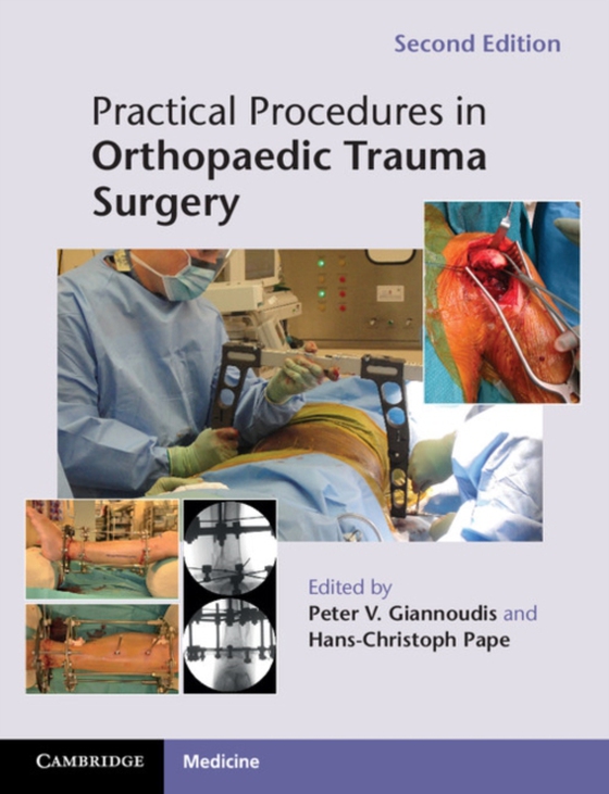 Practical Procedures in Orthopaedic Trauma Surgery (e-bog) af -