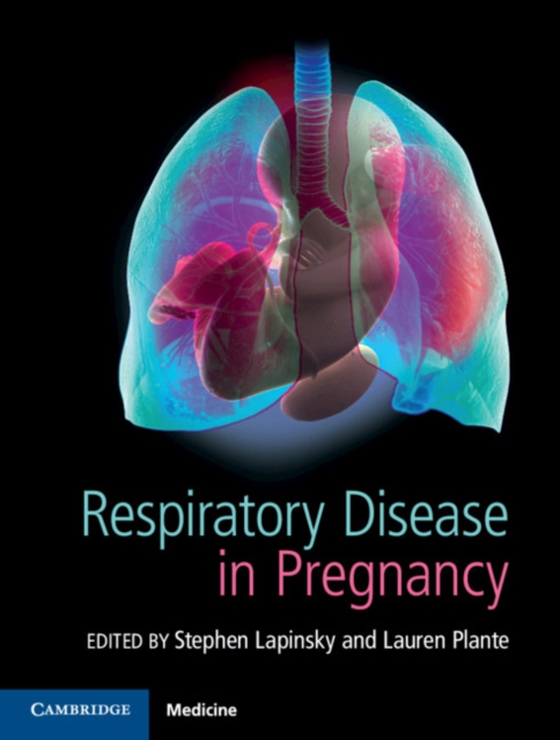 Respiratory Disease in Pregnancy (e-bog) af -