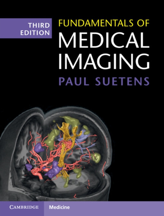 Fundamentals of Medical Imaging (e-bog) af Suetens, Paul