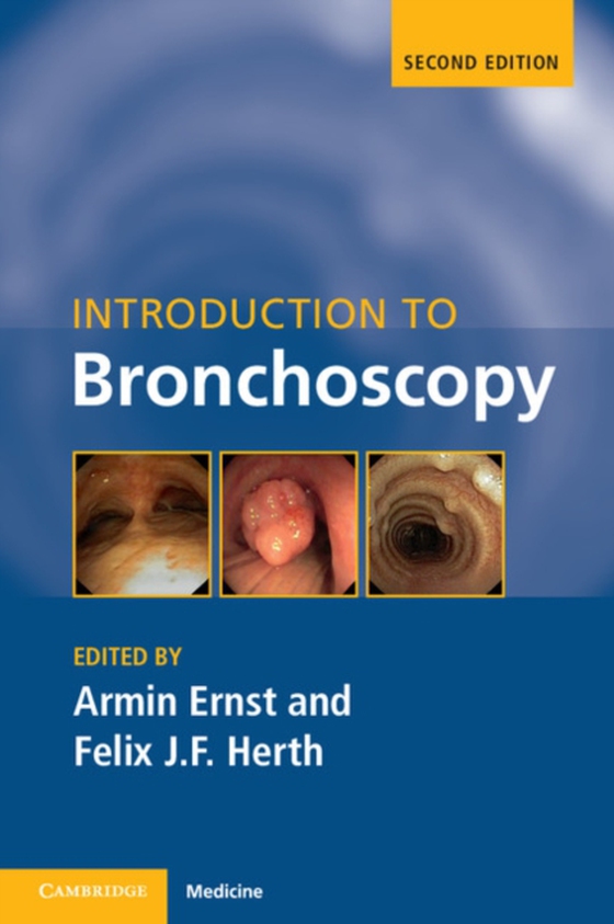 Introduction to Bronchoscopy (e-bog) af -