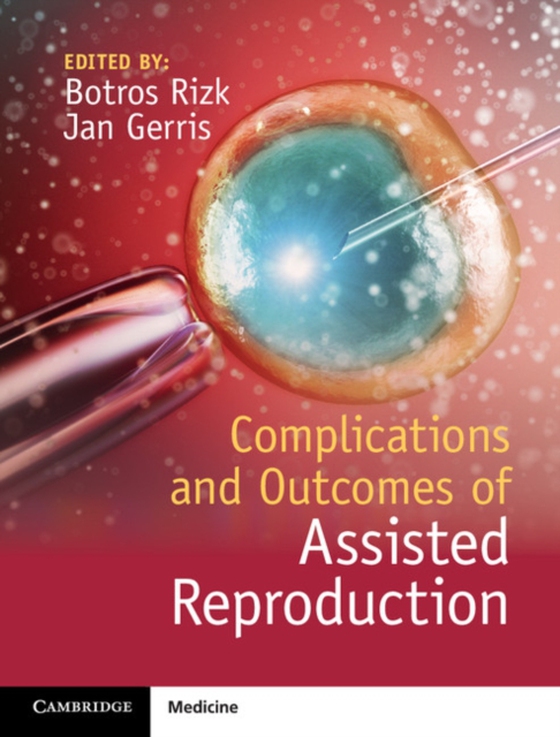 Complications and Outcomes of Assisted Reproduction (e-bog) af -