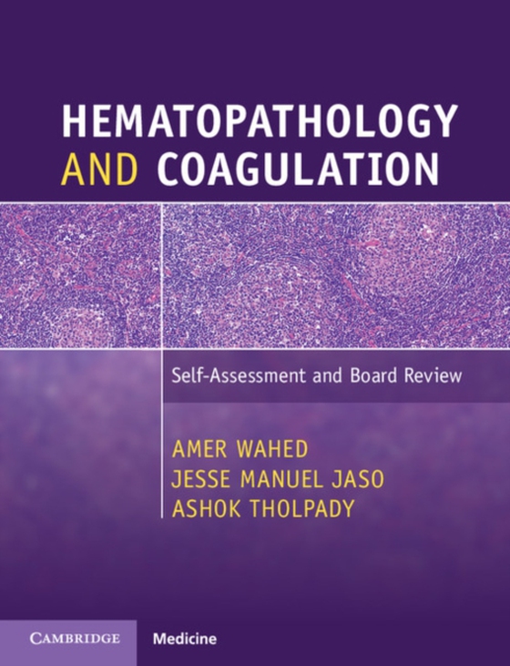 Hematopathology and Coagulation (e-bog) af Tholpady, Ashok