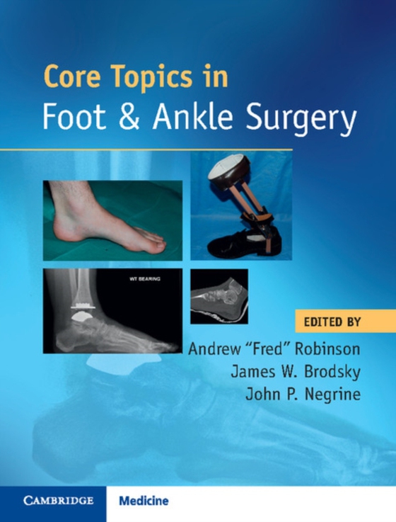 Core Topics in Foot and Ankle Surgery (e-bog) af -