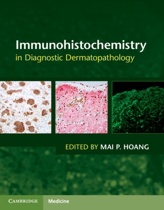 Immunohistochemistry in Diagnostic Dermatopathology (e-bog) af -