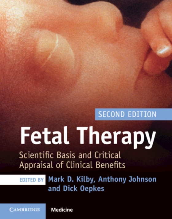 Fetal Therapy (e-bog) af -